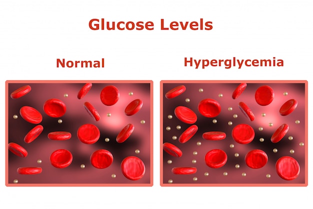 Premium Photo | Glucose levels in the blood, table with normal levels ...