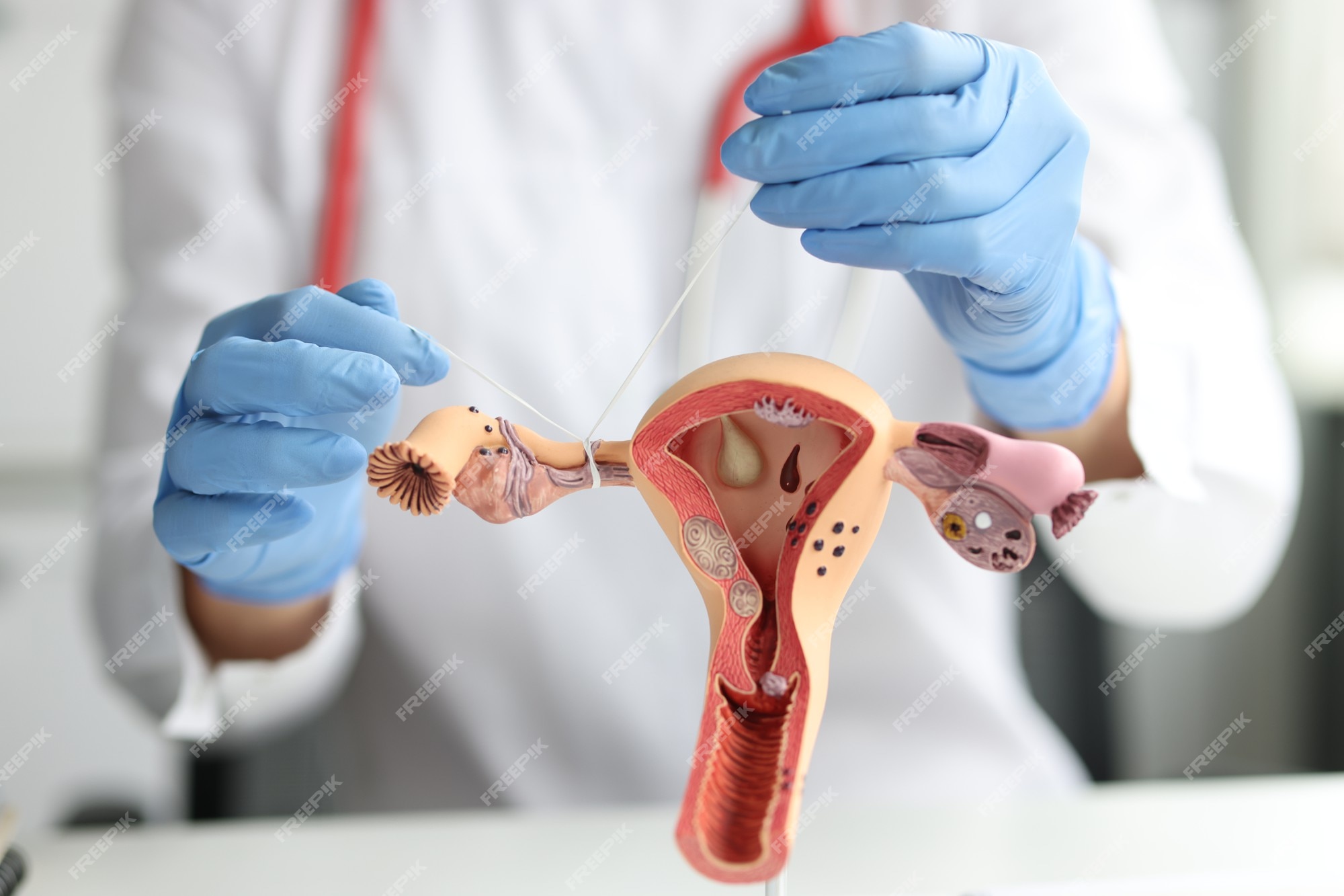 Premium Photo Gynecologist shows how to ligate the fallopian tubes on