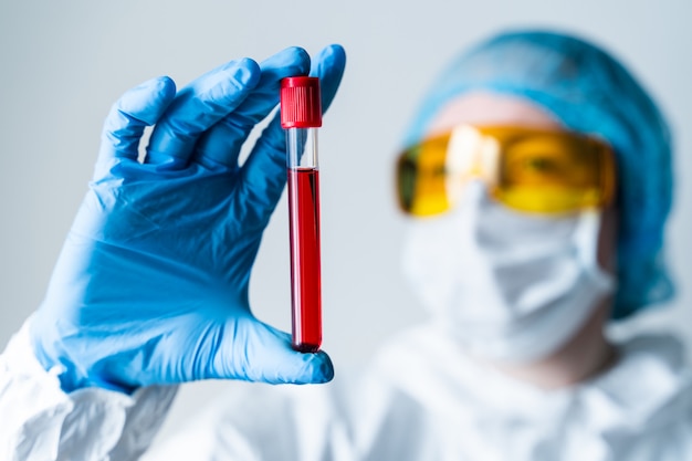 Premium Photo | Hand holding blood in test tube close up