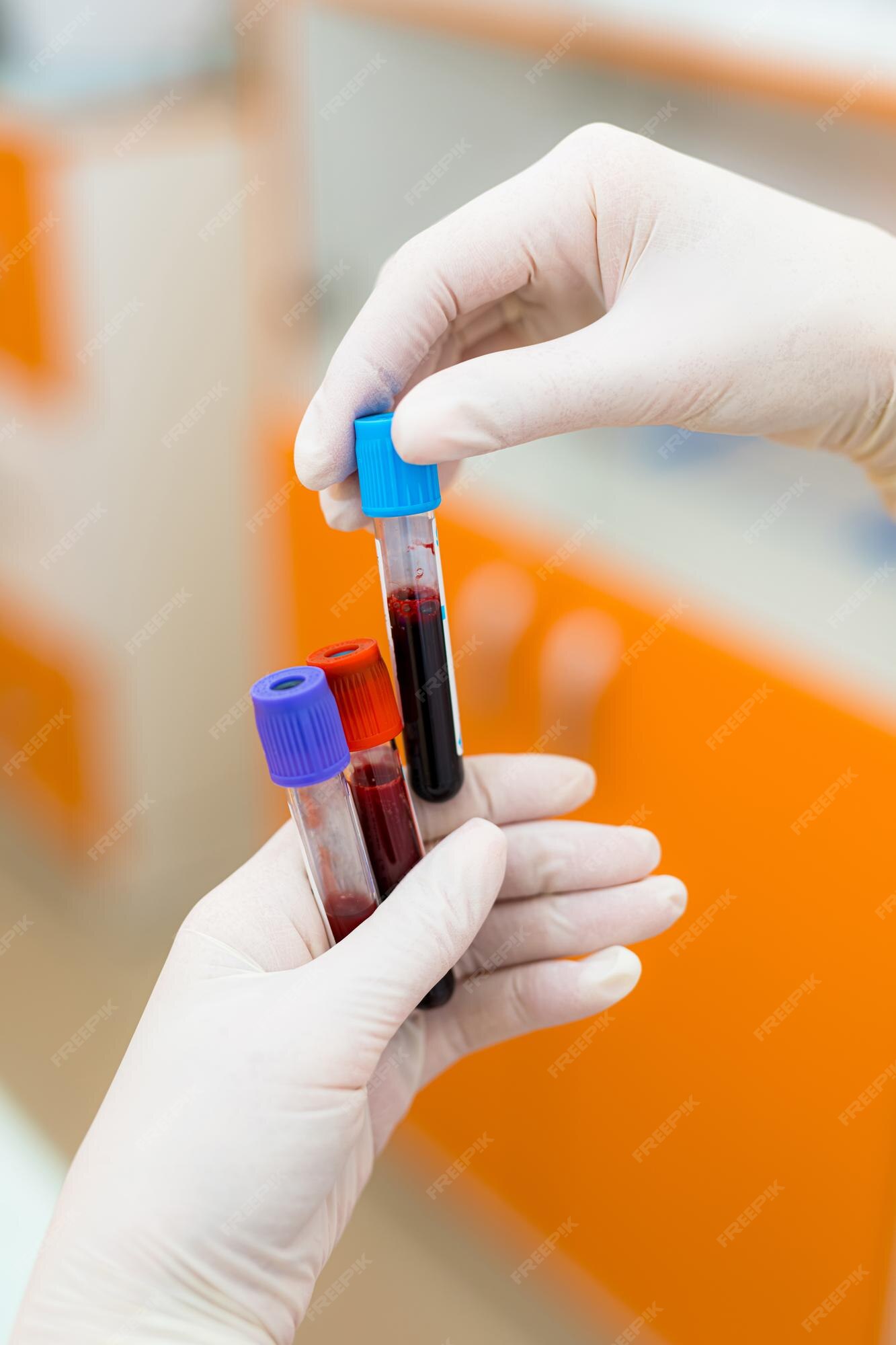 premium-photo-hand-holding-blood-in-test-tube-medical-blood-test-in