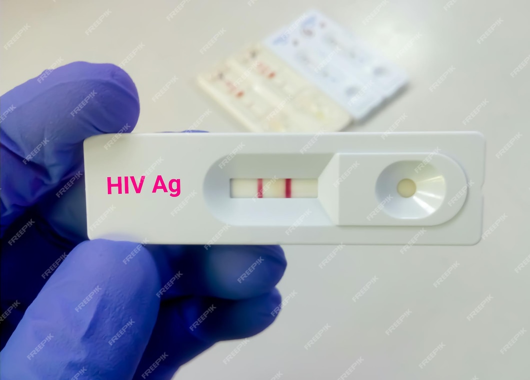 Premium Photo | Hiv antigen positive test result by using rapid test ...