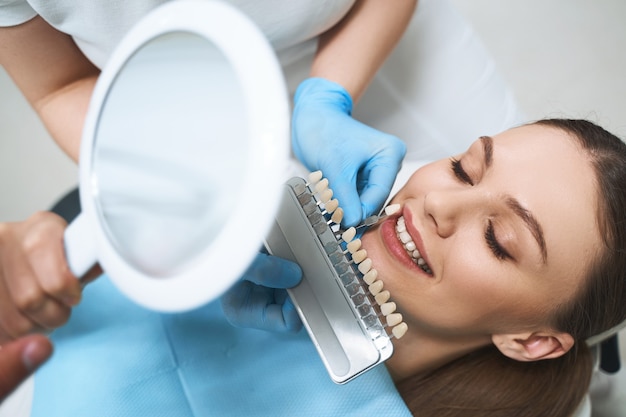 prednosti ljuskica za zube