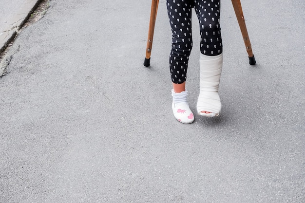 足が骨折した子供は 路上で松葉杖に乗っています 学校の休み 休日に骨折した足を持つ子供を描いた概念的な写真 足で負傷した少女はアスファルトに松葉杖で包帯をしています プレミアム写真