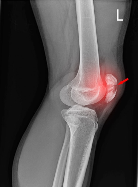 knee-joint-x-ray_34251-287.jpg