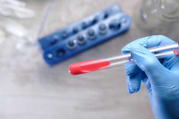 Premium Photo Laboratory Technician Hand Holding Blood Test Tube