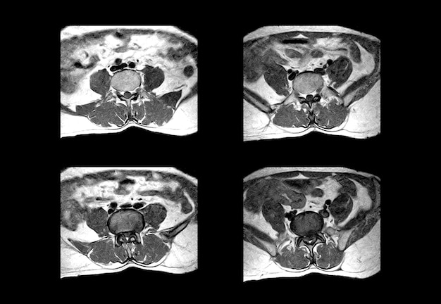 Premium Photo | Lower spine ct scan and mri professional images