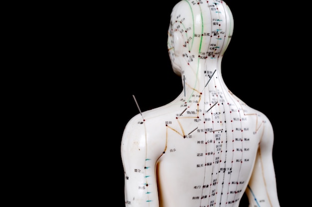 Premium Photo | Male Acupuncture Model With Needles