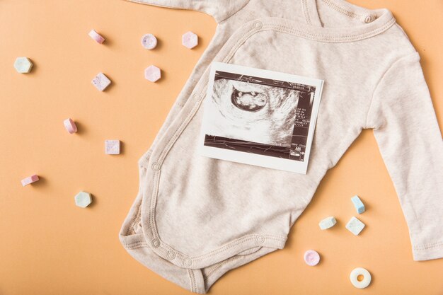 tan baby onesie
