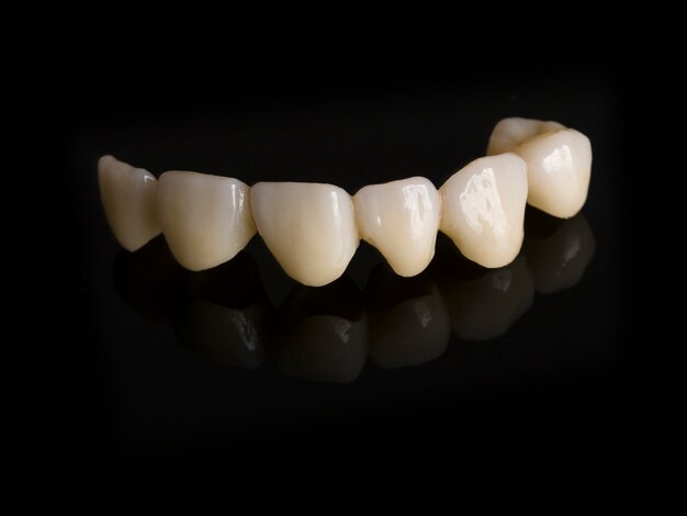 Premium Photo | Monolithic zirconia restorations full arch implant ...