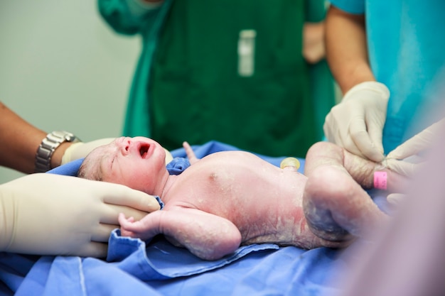 Newborn baby in labor room Premium Photo