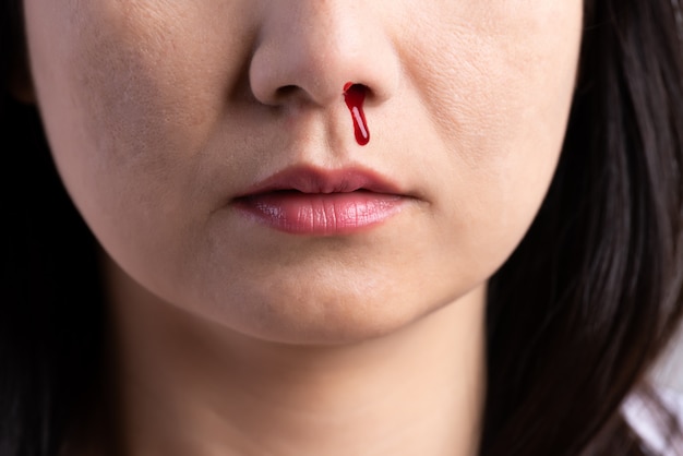 鼻血 血まみれの鼻を持つ女性 ヘルスケアの概念 プレミアム写真