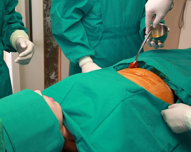 premium-photo-operation-being-performed-on-a-stomach-by-surgeons