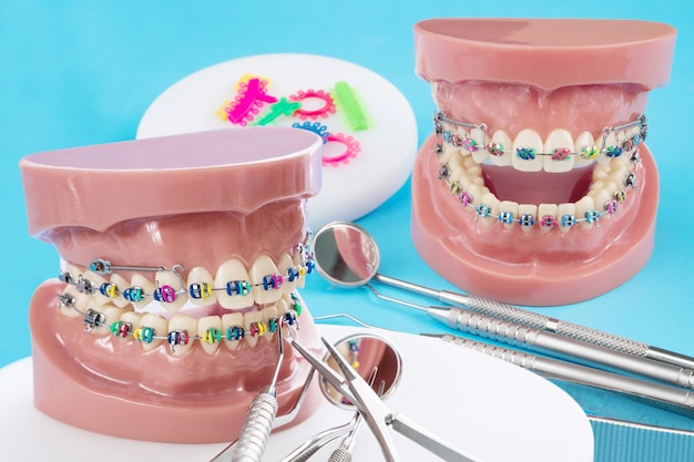 orthodontist toy set