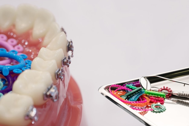 Premium Photo Orthodontic Model And Dentist Tool Demonstration Teeth Model Of Varities Of 