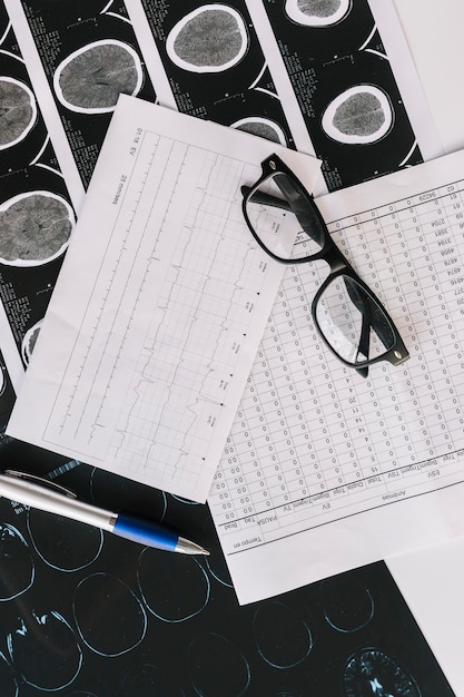 An overhead view of mri scan with reports; pen and black spectacles Free Photo