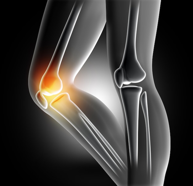 膝関節の痛み | 無料の写真