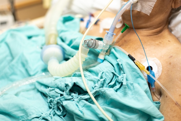 Premium Photo | Patient do tracheostomy and ventilator in the hospital