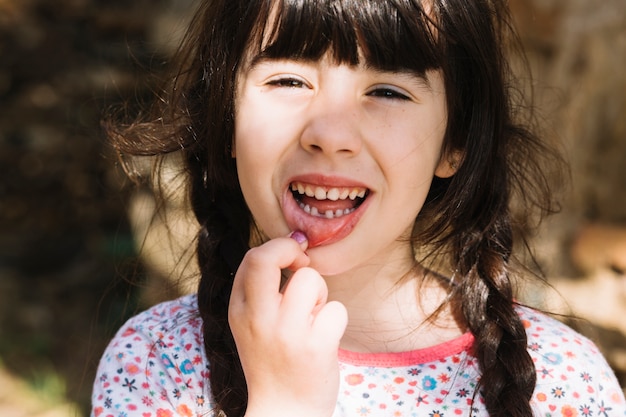 Portrait of a cute little girl showing her broken teeth Free Photo