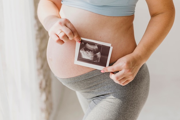 Pregnant woman holding a sonogram Free Photo