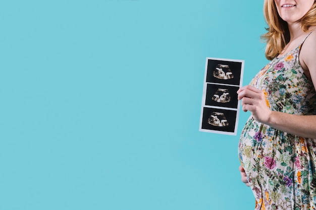 Pregnant woman holding ultrasound Free Photo