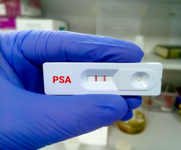 Premium Photo | Rapid Diagnostic Test For Psa Or Prostate Specific Antigen