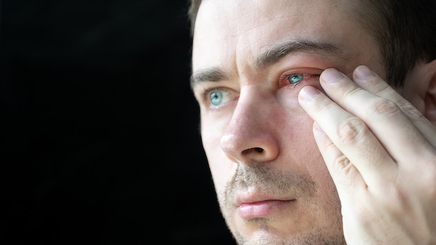 Premium Photo | Sad man touch his severe bloodshot red blood eye ...