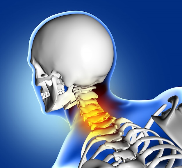 Skeleton with neck pain Free Photo