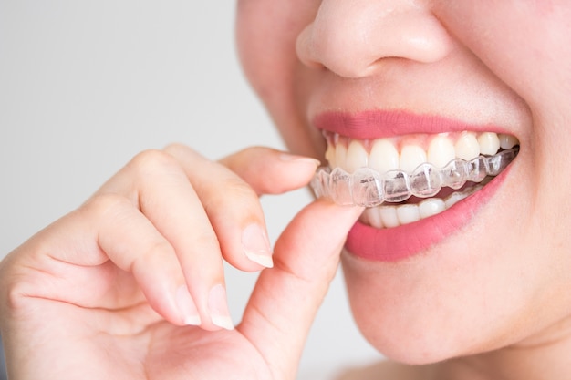 Premium Photo | A smiling woman holding invisalign or invisible braces