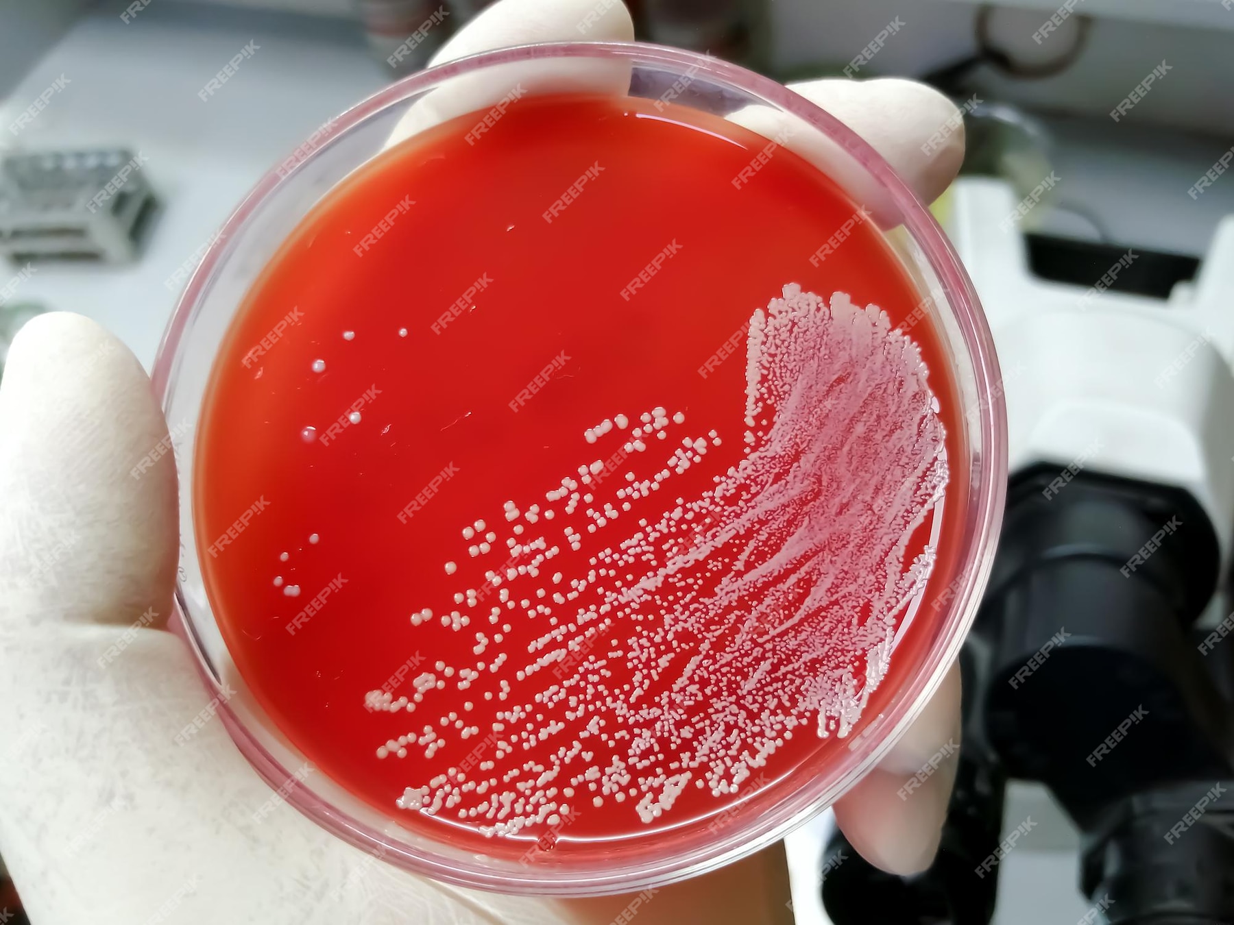 Premium Photo | Staphylococcus aureus growth on blood agar