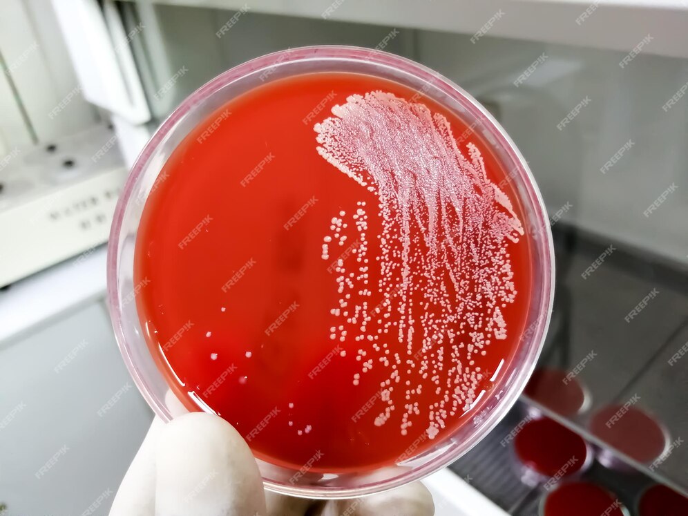 Premium Photo | Staphylococcus aureus growth on blood agar