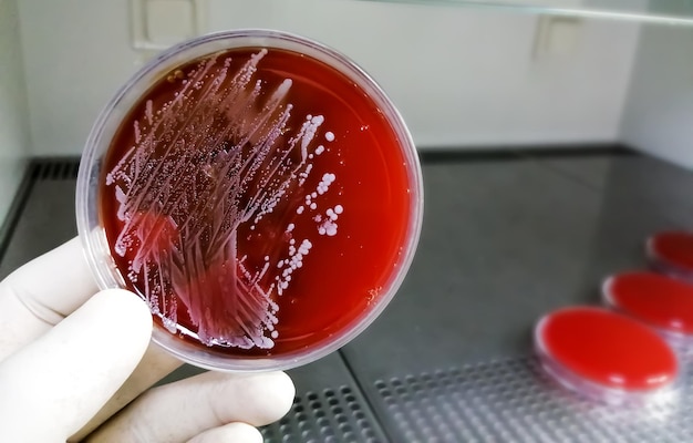 Premium Photo | Staphylococcus Aureus A Type Of Gram Positive Bacteria ...