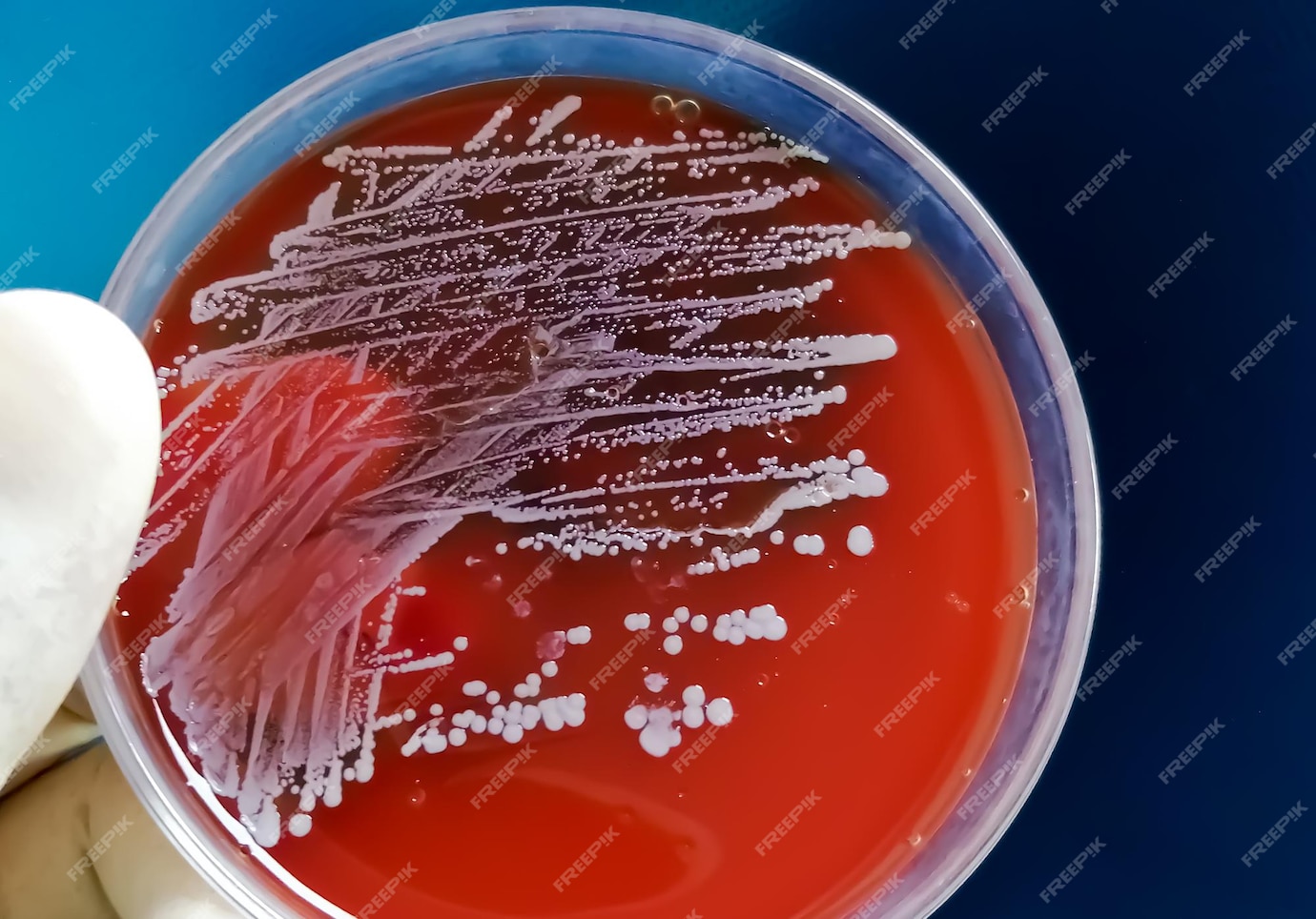 Premium Photo | Staphylococcus aureus a type of gram positive bacteria ...