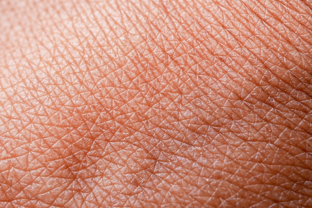 Premium Photo Texture Of The Skin Dark Skin Of Woman Hand Macro