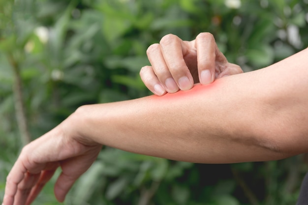 Premium Photo | Women scratch itch with hand. woman scratching her arm ...