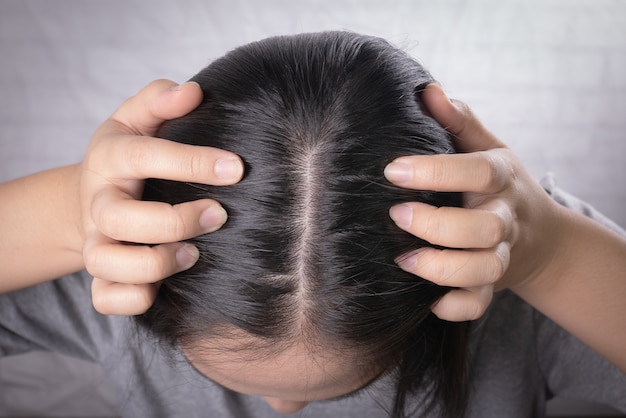 when to worry about hair loss female