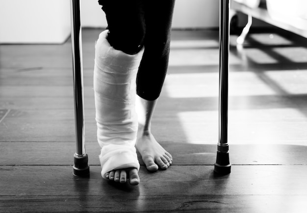 Premium Photo Young Caucasian Girl With Broken Leg In Plaster Cast