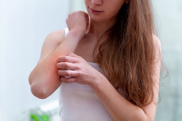 Premium Photo Young Person Suffering From Itching On Her Skin And Scratching An Itchy Place