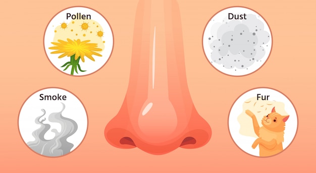 アレルギー性の病気 赤い鼻 アレルギー疾患の症状とアレルゲン 煙 花粉 粉塵アレルギー漫画イラスト プレミアムベクター
