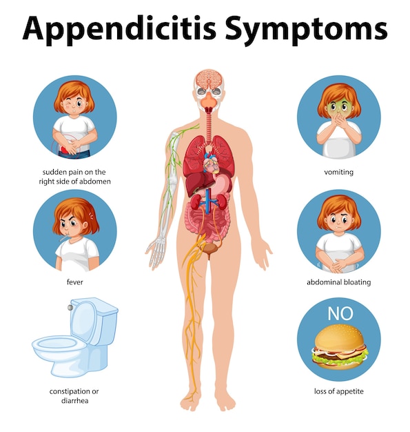 Premium Vector | Appendicitis symptoms information infographic