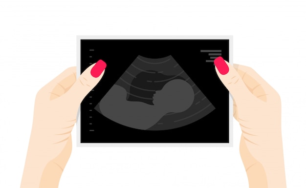 Download Premium Vector | Baby ultrasound picture in womans hands ...