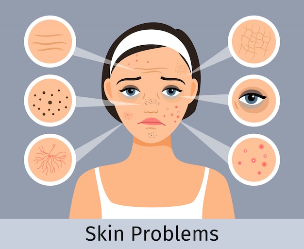 Beauty and freshness of the woman face vector illustration. girl with skin spots, pimples and wrinkl