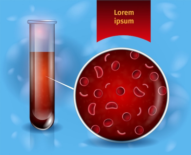 Premium Vector Blood Test Vector Concept