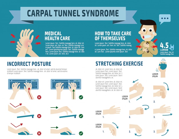 Premium Vector | Carpal Tunnel Syndrome Infographic,