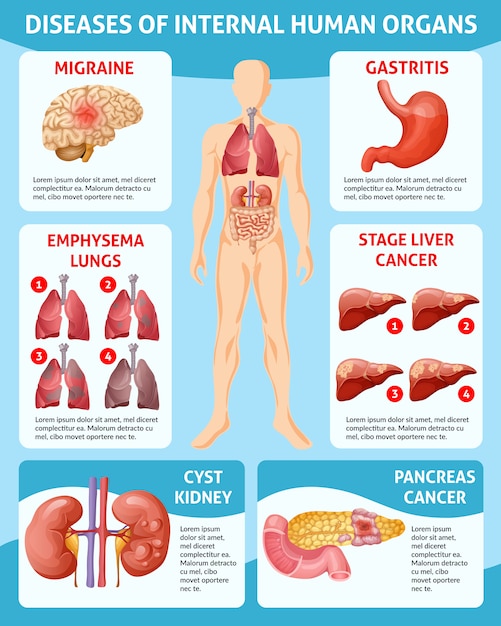 Koncepciya Infografiki Medicinskoj Pomoshi Multfilm Besplatno Vektory