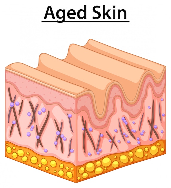 Aged Skin illustration