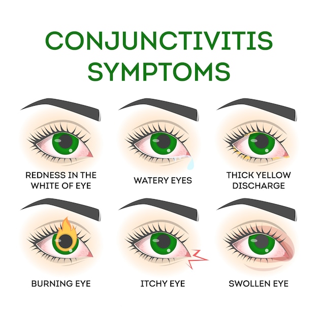 Premium Vector Conjunctivitis Symptoms Pink Eye Disease Infection And Allergy Problem With 9900