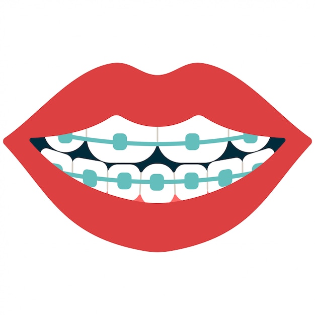 Premium Vector | Dental braces cartoon isolated on white