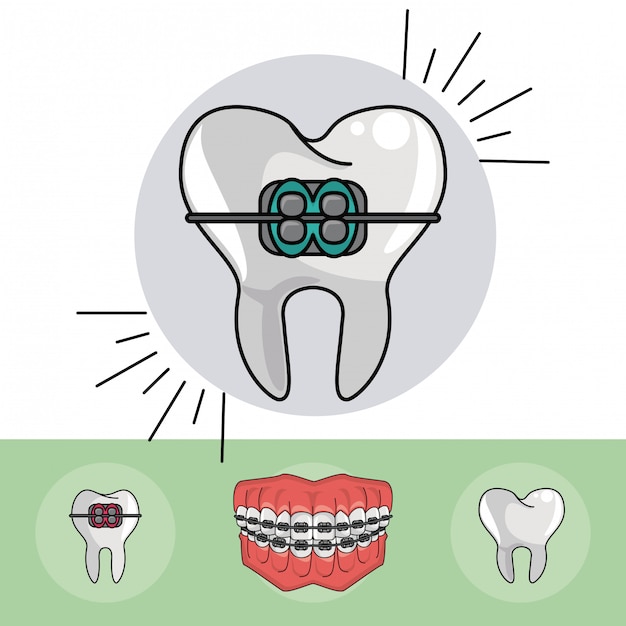 Premium Vector Dental Braces Elements