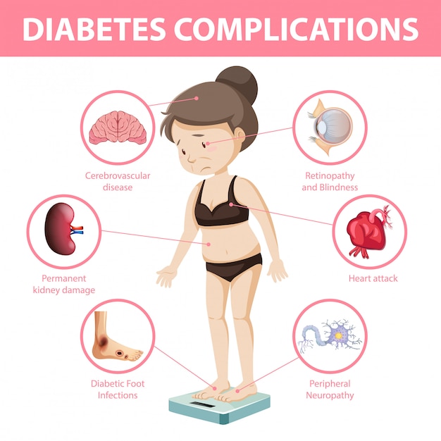 Diabetes Complications Information Infographic Free Vector 