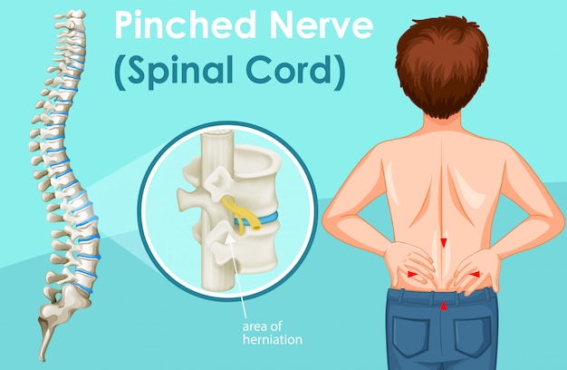 Diagram showing back pain in human Premium Vector